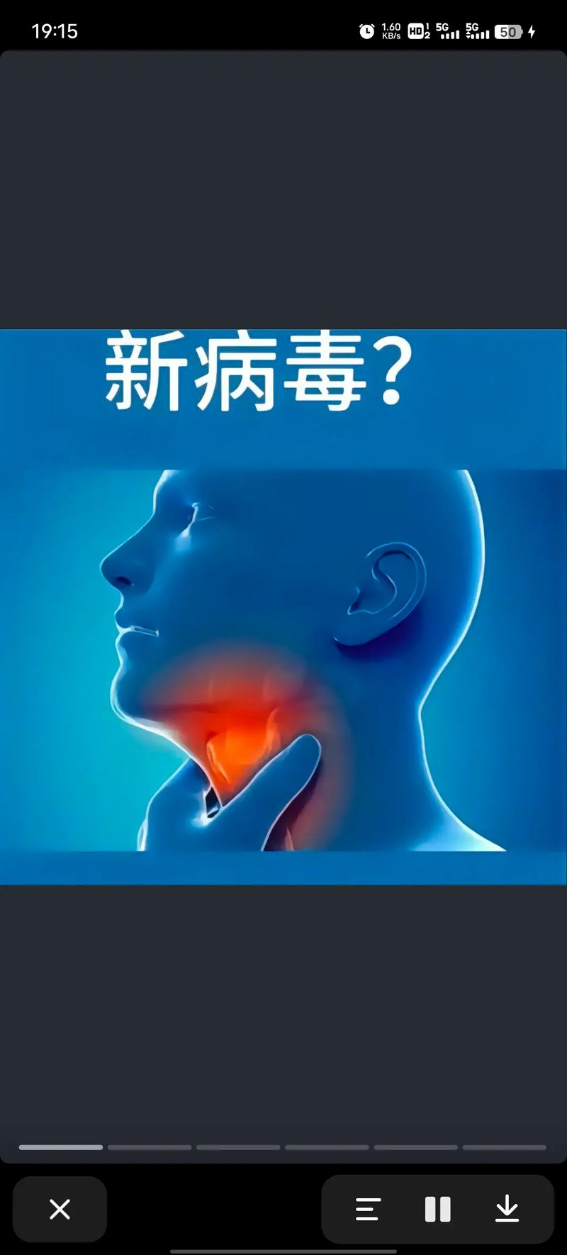 这个病毒号称是“病毒界的扛把子”,它是?儿童易患,家长千万要注意……