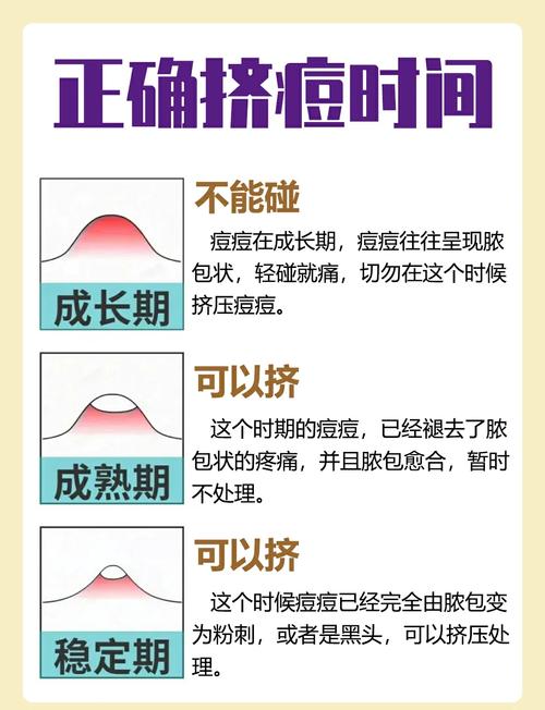 那些经常挤痘痘的人,后来都怎么样了?_1