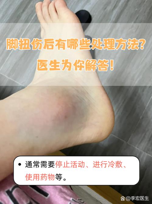 奥孔古遭遇脚趾扭伤 7-10天后重新评估