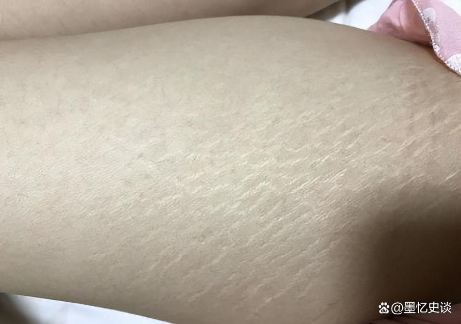 身材决定癌症!权威研究:身体“1大1长”的人,更易成为癌症候选人!