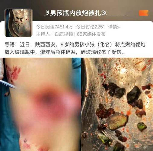 烟花爆竹燃放操作不当引发事故致3人受伤,河南焦作山阳区通报了