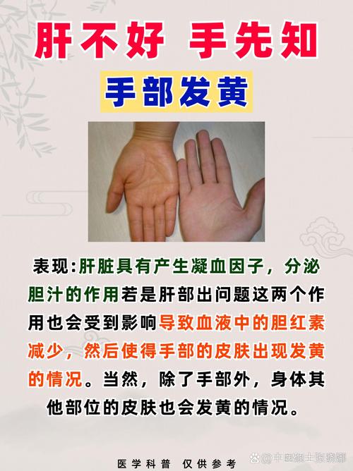 皮肤瘙痒人发黄可能是肝出了问题 医生教你怎么看体检指标