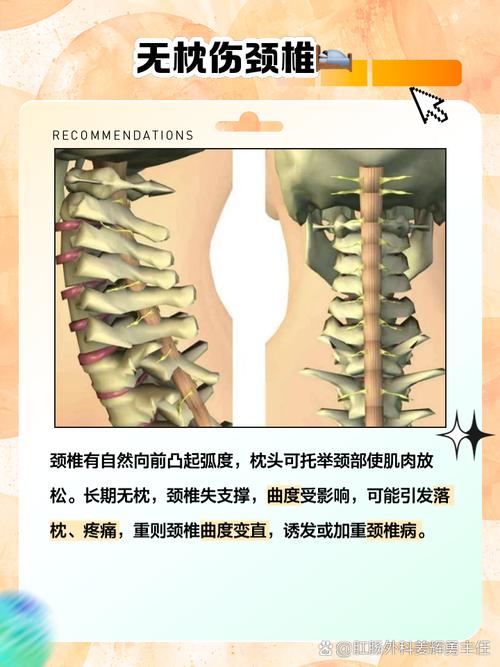 高枕并非无忧 新研究显示使用过高枕头可能诱发自发性椎动脉夹层_1