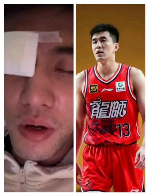 郭艾伦眼睛受伤缝了40多针!陶勇医生:结膜裂伤可以恢复到很好,不会影响运动生涯